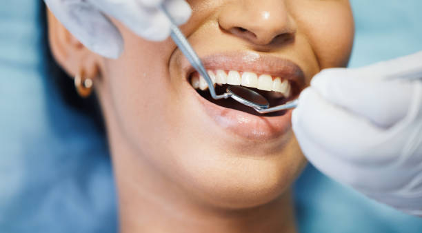 Best Cosmetic Emergency Dentistry in Pebble Creek, FL
